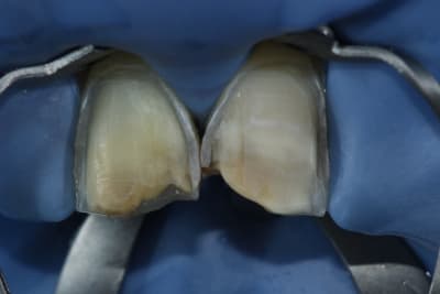  mg 3119 hc032k - Eugenol