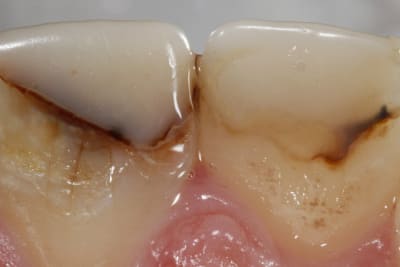  mg 3250 w3wyp2 - Eugenol