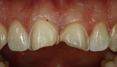  mg 3507 jitj0q - Eugenol