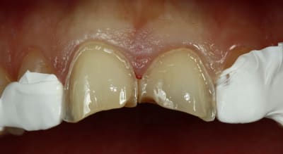  mg 3622 ifimuz - Eugenol