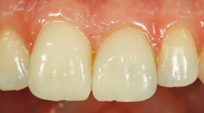  mg 3662 vy4mwm - Eugenol