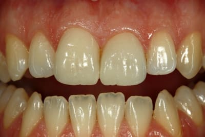  mg 3666 q3zjiw - Eugenol