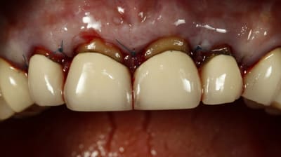  mg 3705 si77ut - Eugenol