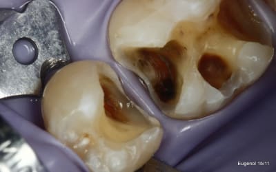  mg 5036 001 u7kegm - Eugenol