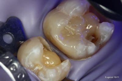  mg 5042 001 dqjvlw - Eugenol