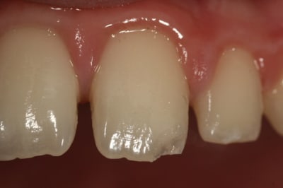  mg 7390 x3iit2 - Eugenol
