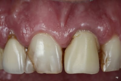  mg 8474 opkpzm - Eugenol
