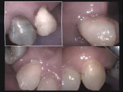  haut droit avant 1 nze1gh - Eugenol