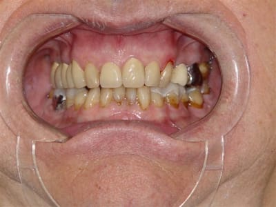  hui l56lhx - Eugenol