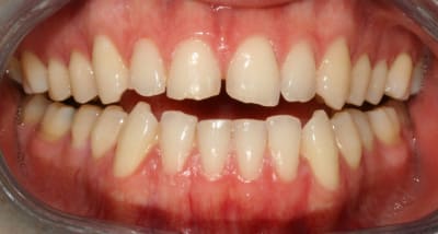  rosion 2 1 urws5c - Eugenol