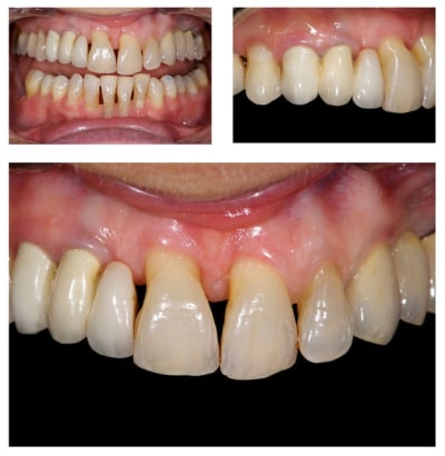 A   copie vhb0qr - Eugenol