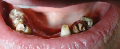 A xhdmjl - Eugenol