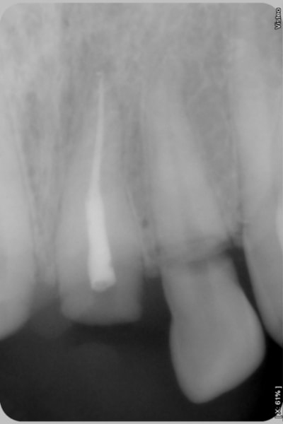 Aaa plksgs - Eugenol