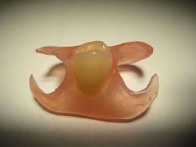 Ackers valplast 1 dent wd3qpz - Eugenol