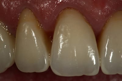 Aie  5  jkr0rb - Eugenol