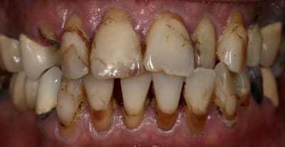 Aie tbxecd - Eugenol