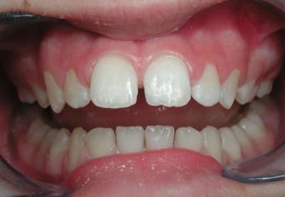 Alexane mcx5ln - Eugenol