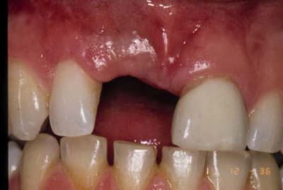 Amant2 r1kapk - Eugenol