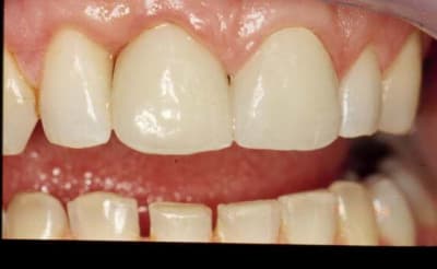 Amant8 kiqhod - Eugenol