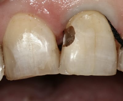 Amaris pqopk6 - Eugenol