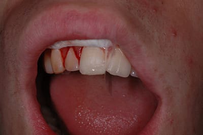 Angletemp hyfdzw - Eugenol