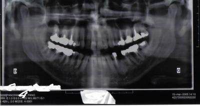 Annie pano hmefpo - Eugenol