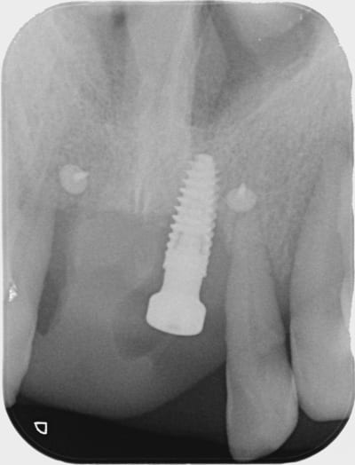 Aoleulv0q7cc21bdtwccvaev36xs - Eugenol