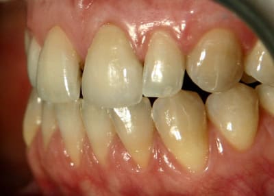 Ap mtqekc - Eugenol