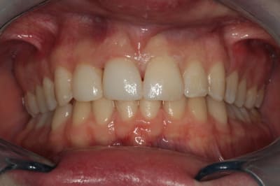 Apr s fsnklh - Eugenol