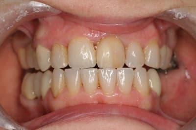 Apr s nk2g2e - Eugenol