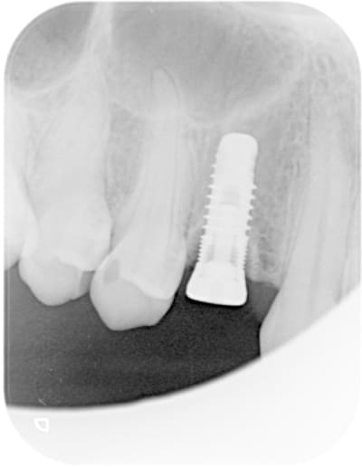 Apr s uoq7on - Eugenol