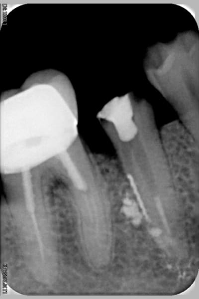 Arg eetpwy - Eugenol