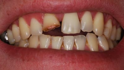 Argh dgbbe4 - Eugenol