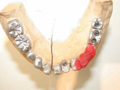 Armature lwbco2 - Eugenol