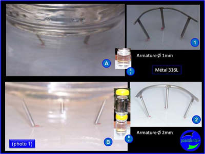 Armature m tal rigide pour mci positdental 1 qsaqs5 - Eugenol