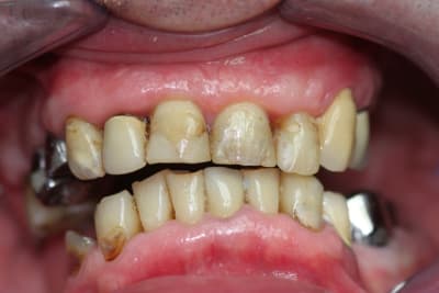 Avant2 plze5t - Eugenol