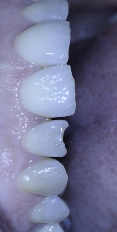 Avant u5olse - Eugenol