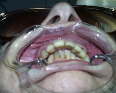 Aya9 fr9ywe - Eugenol