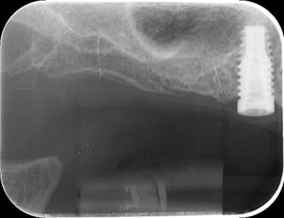 B78yboi5sgcmslwiyhtn - Eugenol