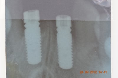 Barroz 008 k2gnfr - Eugenol
