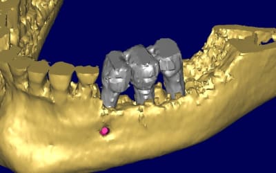 Bernard 3d3 cnyyxx - Eugenol