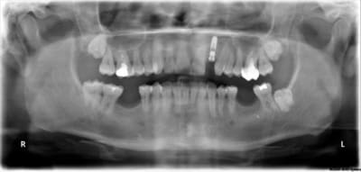 Bo4 x7unrb - Eugenol