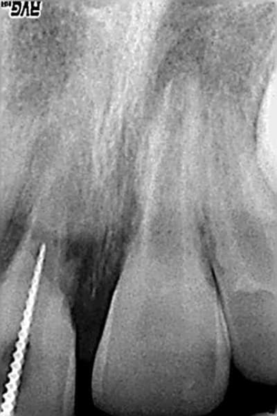 Broche lpbl4w - Eugenol