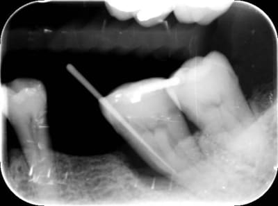 Brun lcnb5w - Eugenol