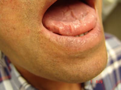 Bu2 fx8qkk - Eugenol