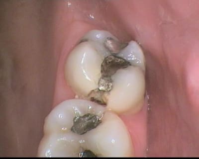 Ca fait pas mal wjgvdj - Eugenol