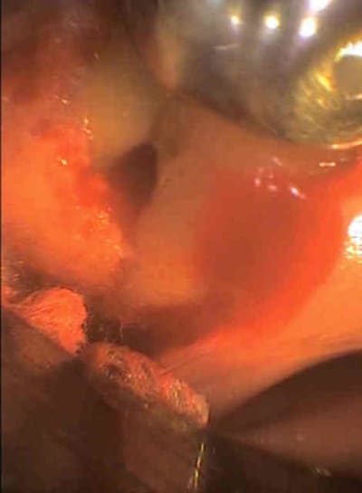 Cab2 w0qoqs - Eugenol