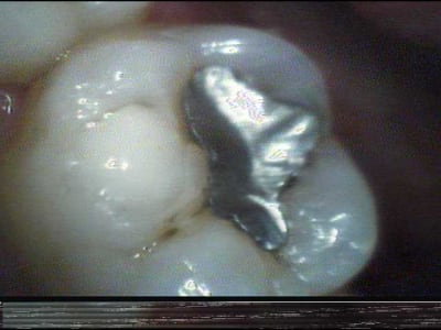 Capt0005 w2jyvz - Eugenol
