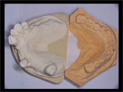 Cas clinique du dr jean koskievic 11 r0csum - Eugenol