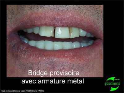 Cas clinique du dr jean koskievic 13 vpp1zr - Eugenol